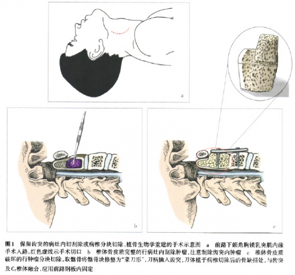 图1.png