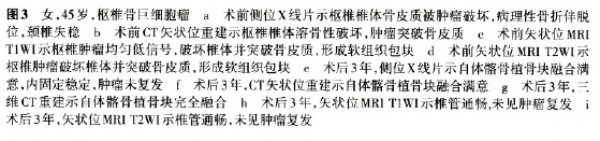 图3图注.png