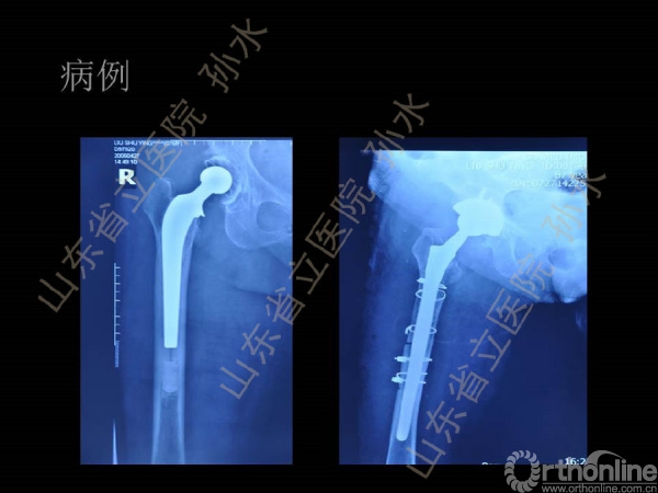 幻灯片15.JPG