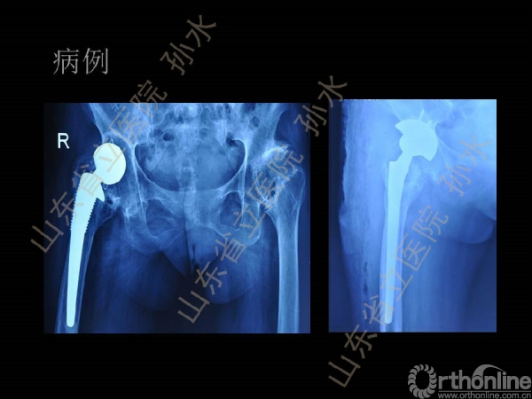 幻灯片22.JPG