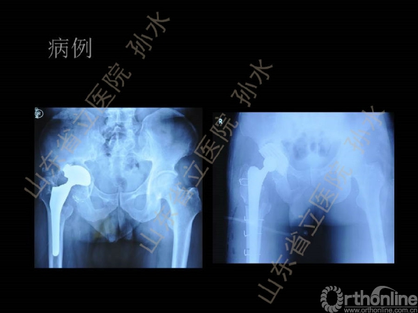 幻灯片23.JPG