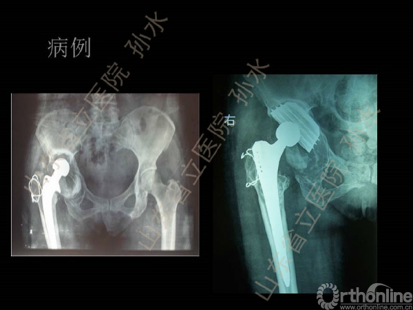 幻灯片28.JPG