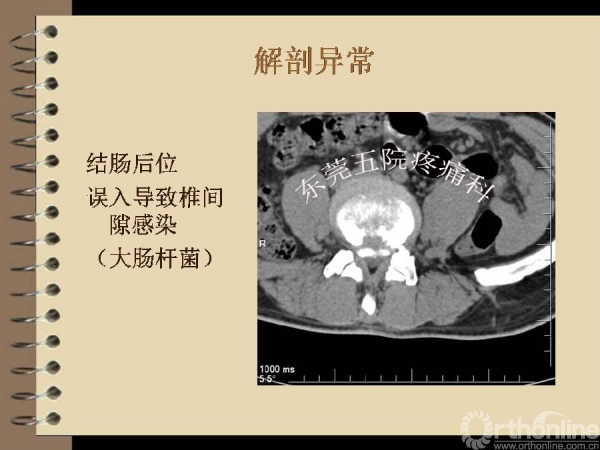 幻灯片11.PNG