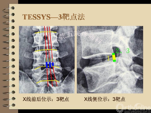 幻灯片32.PNG