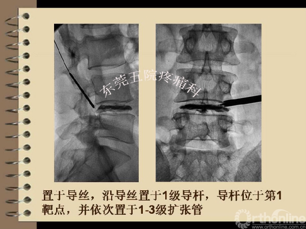 幻灯片44.PNG