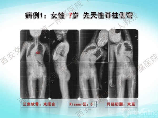 幻灯片2.png