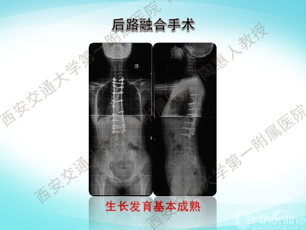 幻灯片5.png