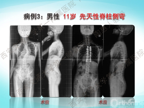 幻灯片31.png