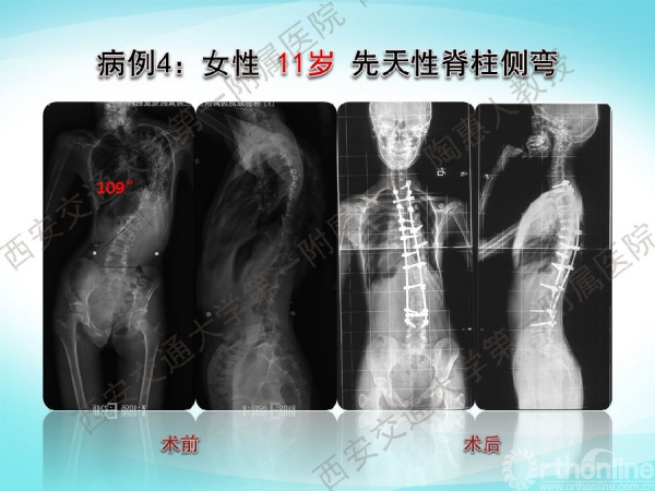 幻灯片32.png