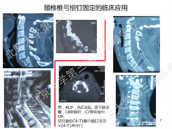 幻灯片7.png