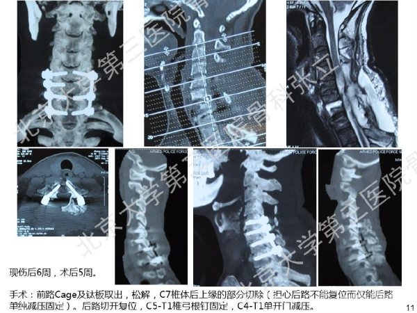 幻灯片11.png