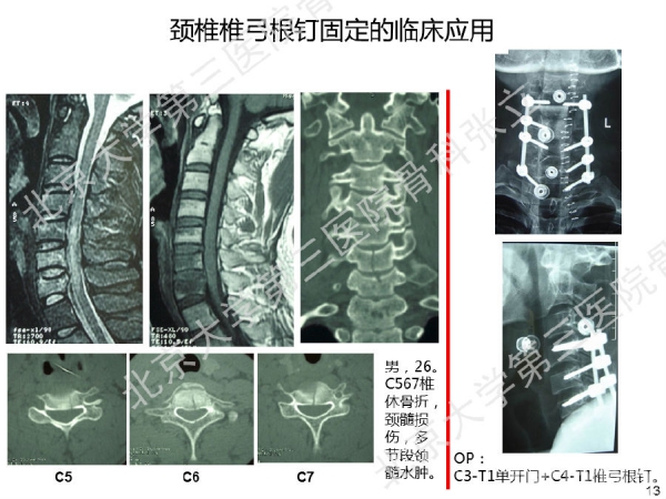 幻灯片13.png