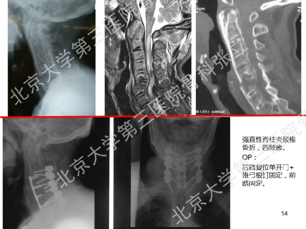 幻灯片14.png