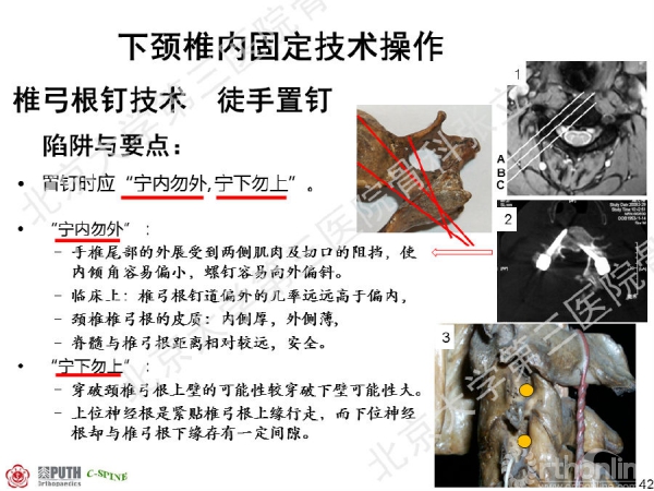幻灯片42.png
