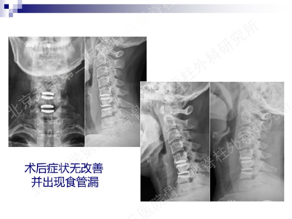 幻灯片33.png