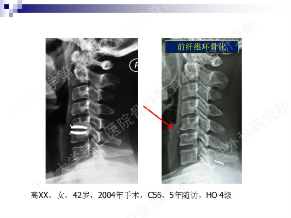 幻灯片43.png