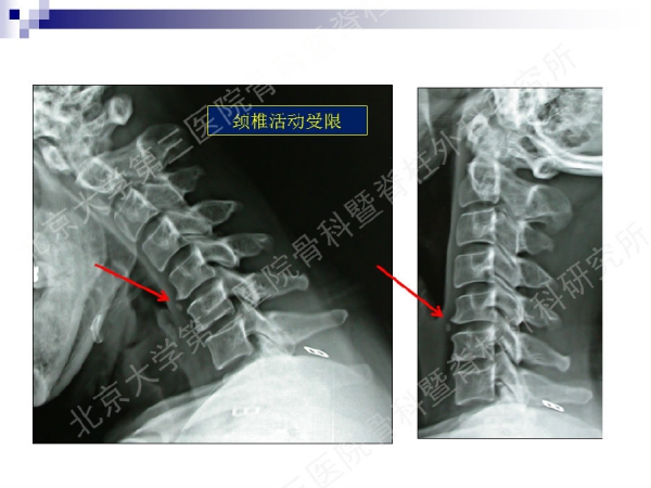 幻灯片44.png