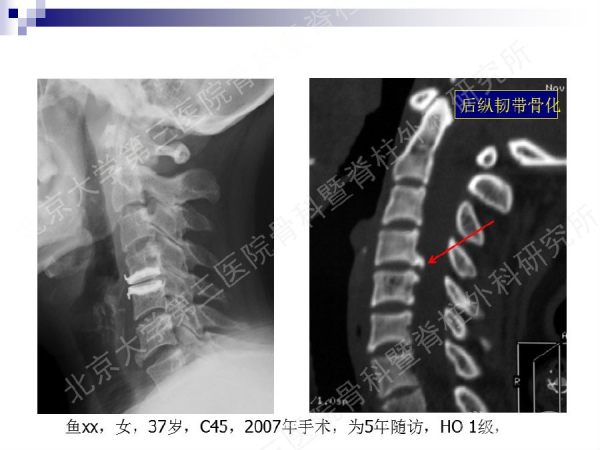 幻灯片54.png