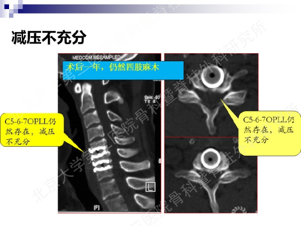 幻灯片62.png