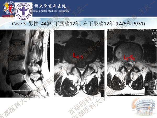 幻灯片22.png