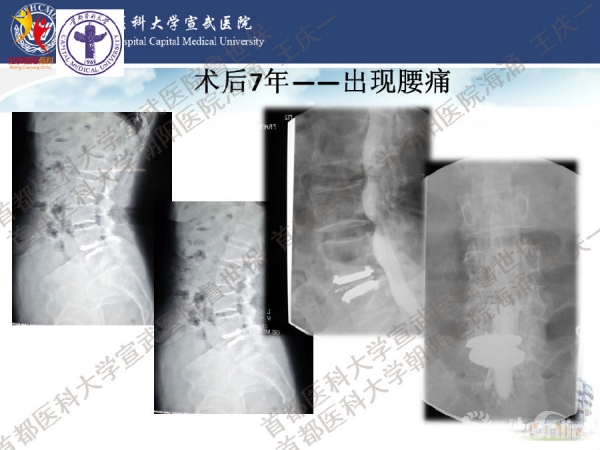 幻灯片33.png