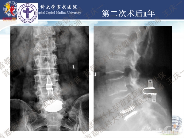 幻灯片35.png