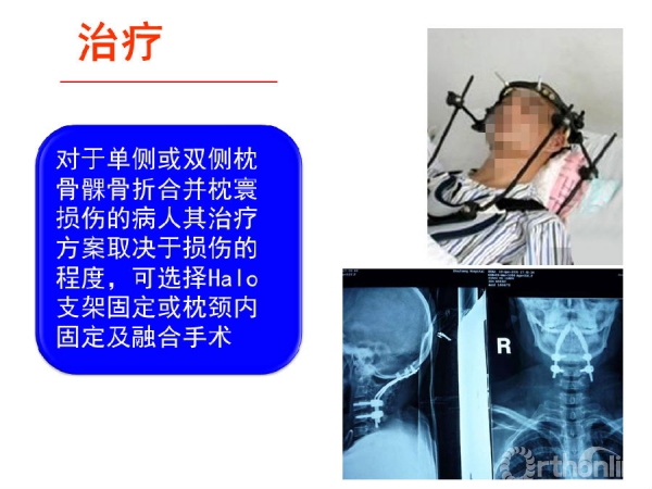 幻灯片17.PNG