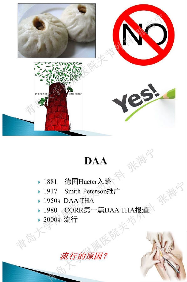 比基尼入路微创人工全髋关节置换术_页面_03.png