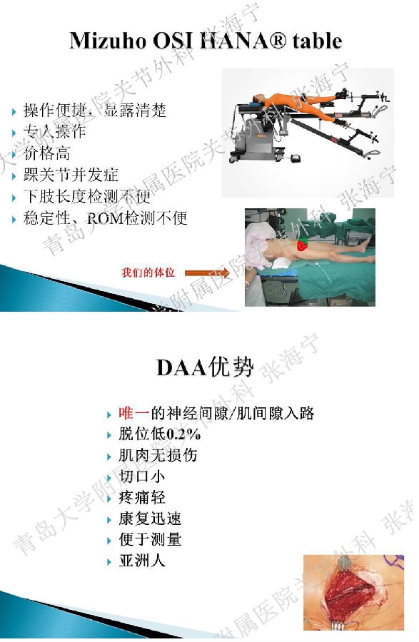 比基尼入路微创人工全髋关节置换术_页面_04.png