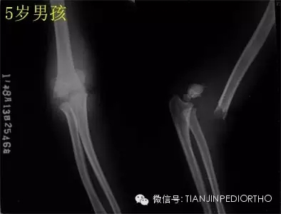 1.webp.jpg