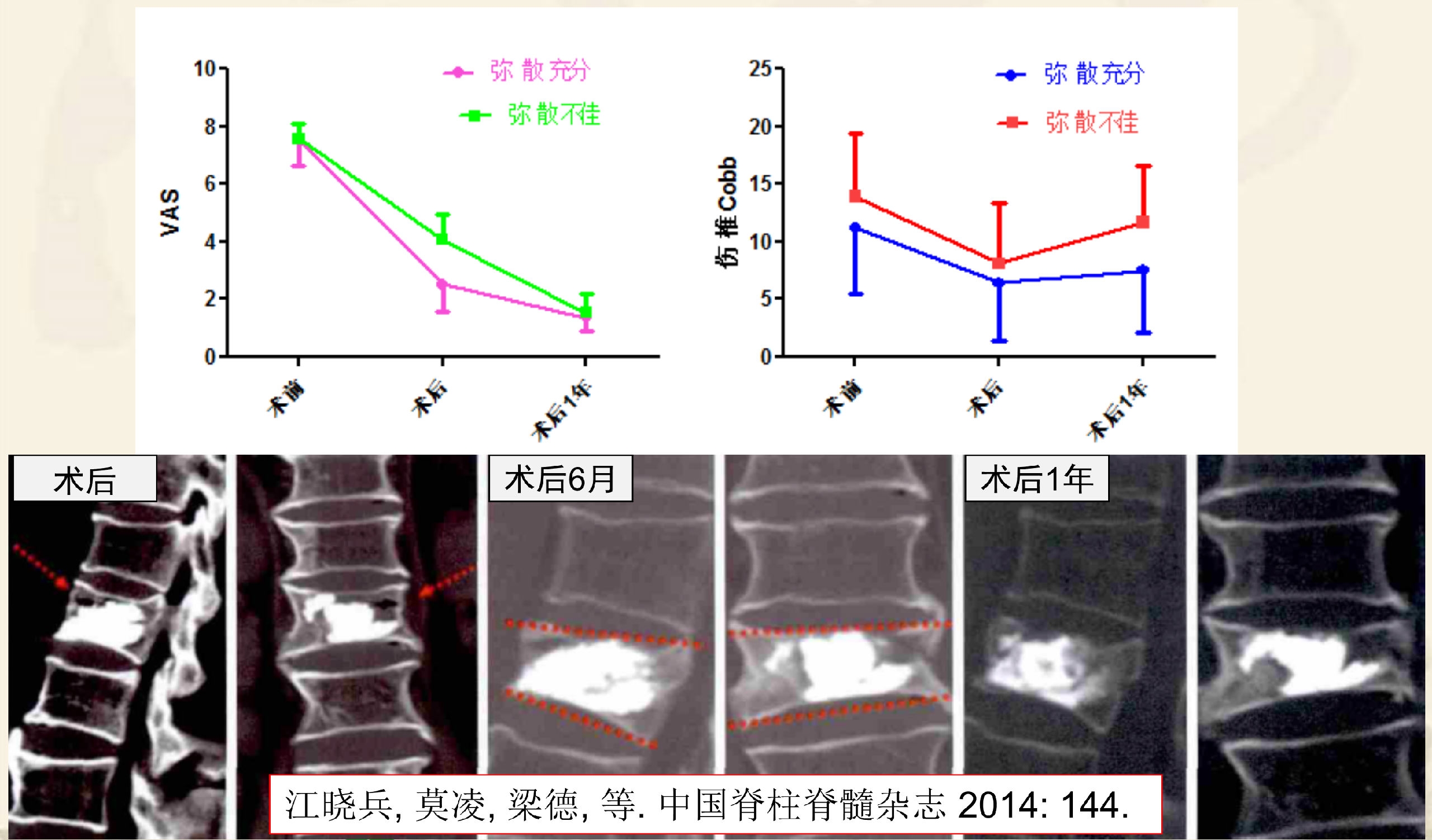 靶向锚定式椎体成形术 完整版(1)_8.png