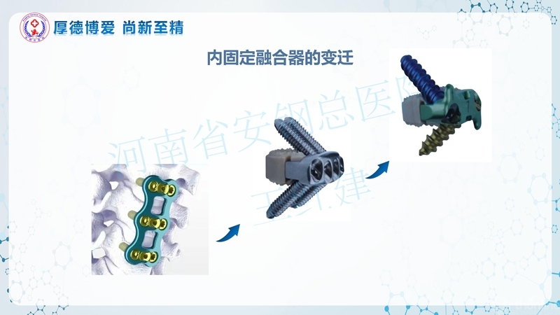 Endo-Assisted-ACDF技术流程与体会_04.jpg
