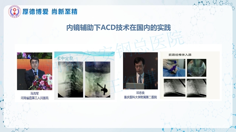 Endo-Assisted-ACDF技术流程与体会_08.jpg