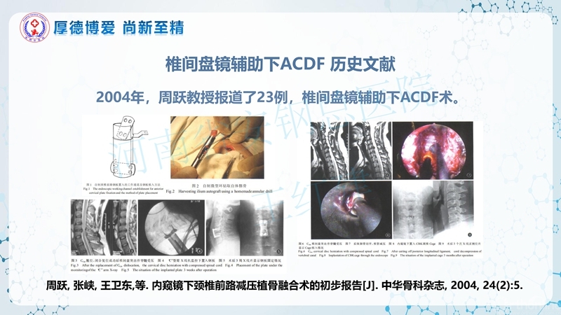 Endo-Assisted-ACDF技术流程与体会_09.jpg