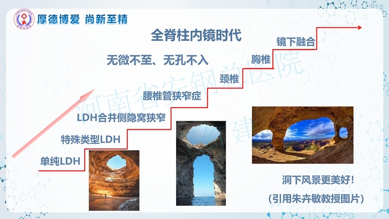 Endo-Assisted-ACDF技术流程与体会_13.jpg
