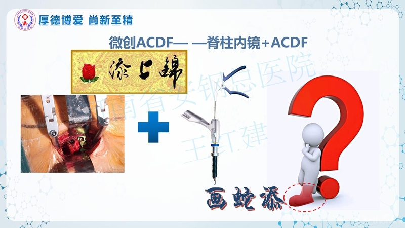 Endo-Assisted-ACDF技术流程与体会_17.jpg