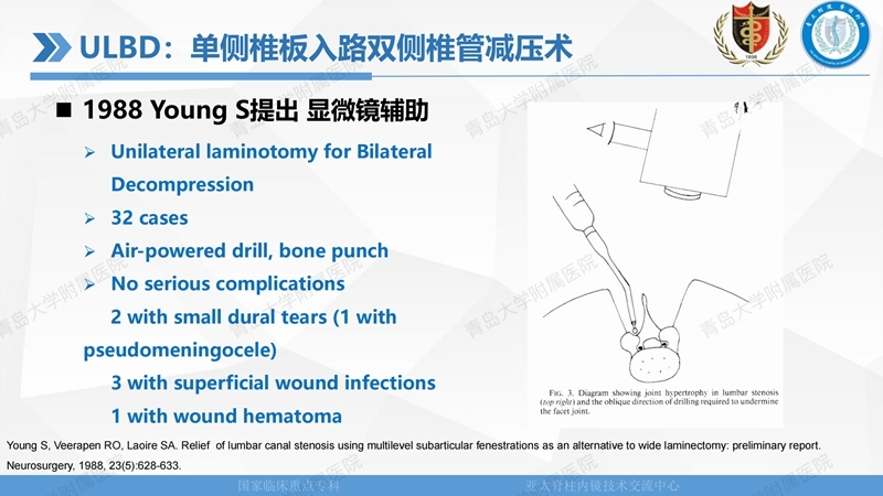 1. ULBD技术体系构建及临床应用 2023.4.5 - 15min_01.jpg