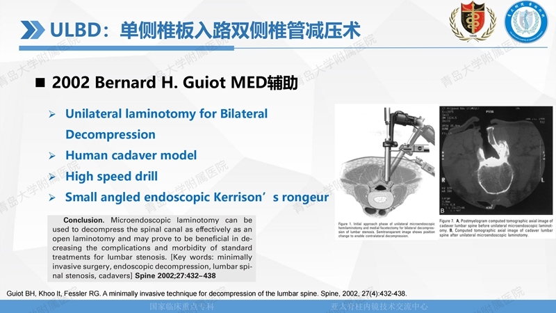1. ULBD技术体系构建及临床应用 2023.4.5 - 15min_02.jpg