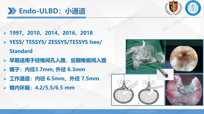 1. ULBD技术体系构建及临床应用 2023.4.5 - 15min_08.jpg