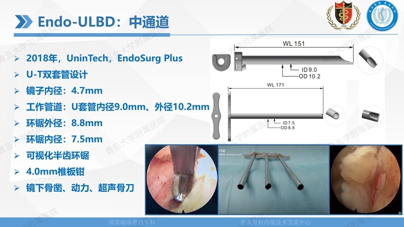 1. ULBD技术体系构建及临床应用 2023.4.5 - 15min_09.jpg