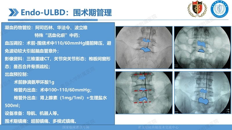 1. ULBD技术体系构建及临床应用 2023.4.5 - 15min_13.jpg