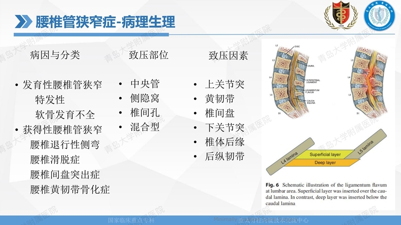 1. ULBD技术体系构建及临床应用 2023.4.5 - 15min_16.jpg