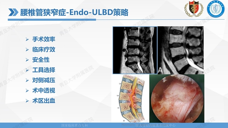 1. ULBD技术体系构建及临床应用 2023.4.5 - 15min_18.jpg