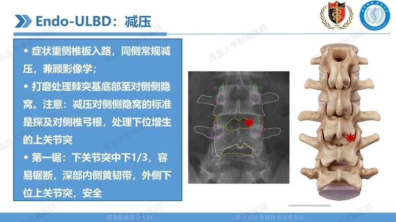1. ULBD技术体系构建及临床应用 2023.4.5 - 15min_22.jpg