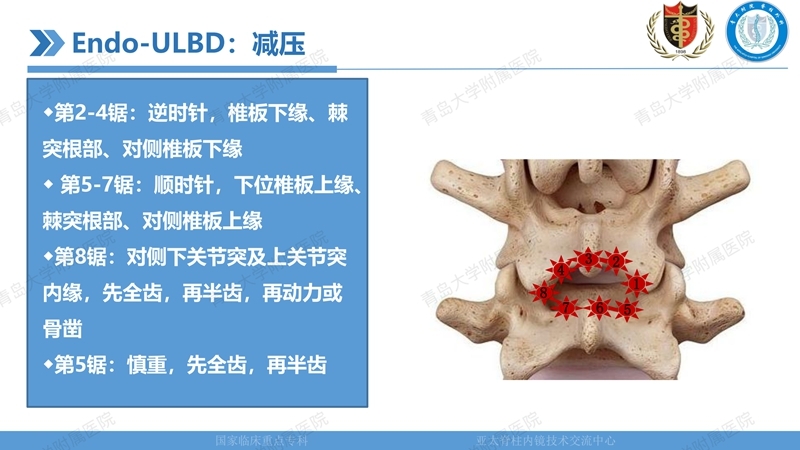 1. ULBD技术体系构建及临床应用 2023.4.5 - 15min_23.jpg
