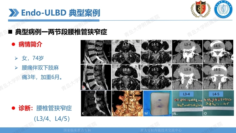 1. ULBD技术体系构建及临床应用 2023.4.5 - 15min_27.jpg