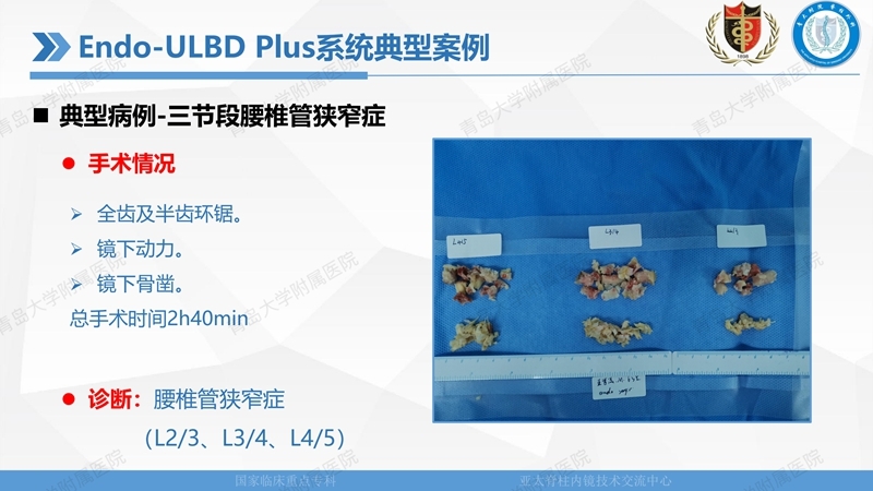 1. ULBD技术体系构建及临床应用 2023.4.5 - 15min_30.jpg