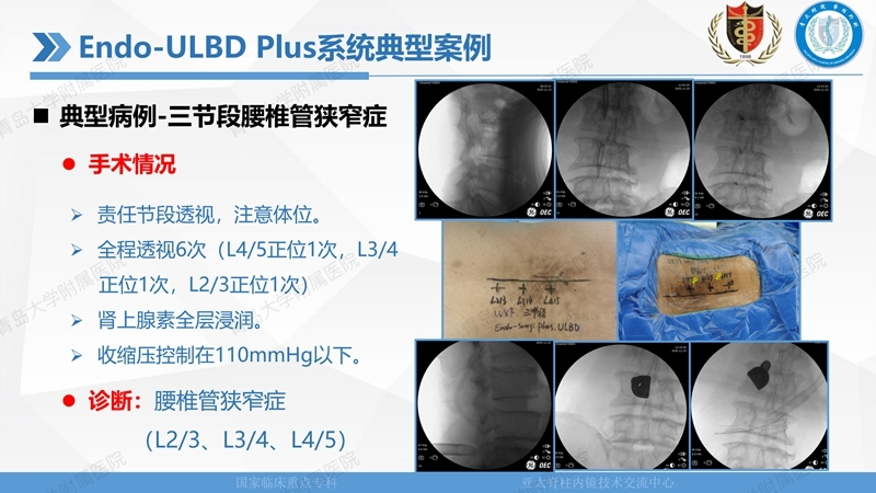 1. ULBD技术体系构建及临床应用 2023.4.5 - 15min_29.jpg