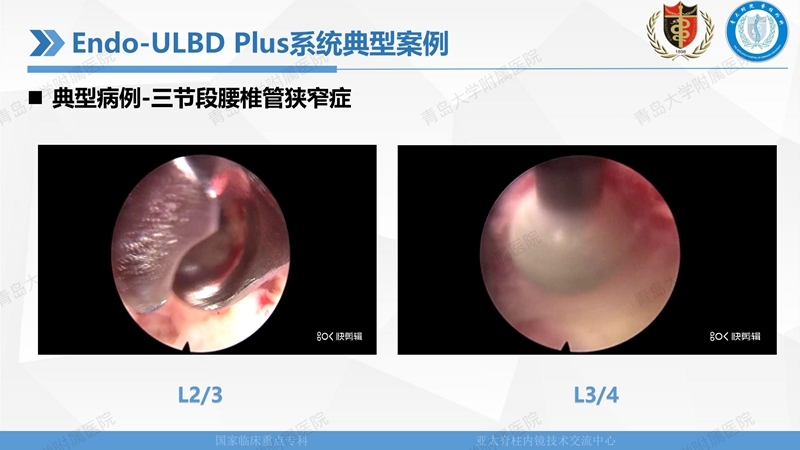 1. ULBD技术体系构建及临床应用 2023.4.5 - 15min_32.jpg