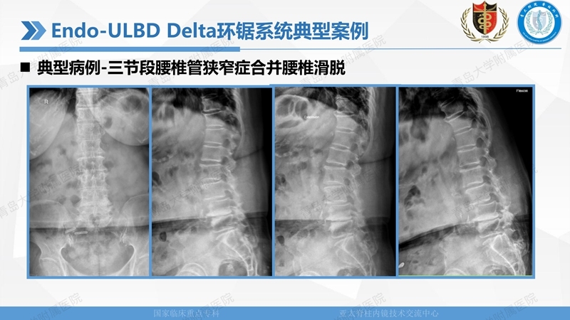1. ULBD技术体系构建及临床应用 2023.4.5 - 15min_36.jpg
